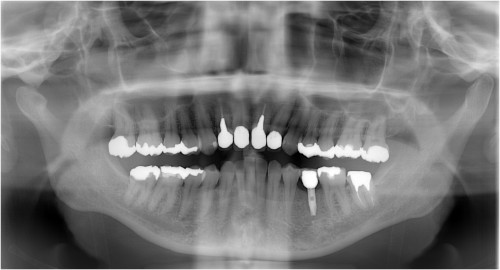 松本12　上部構造装着直後